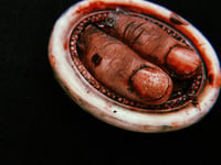 Image 3 of Severed Thumbs in White Oval Frame 