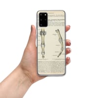 Image 10 of Antique Anatomical Drawing Bones Of The Finger Clear Case for Samsung®