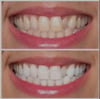 Ultraviolet Teeth Whitening Toothpaste