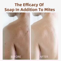 Image 5 of GRIMEL SOAP