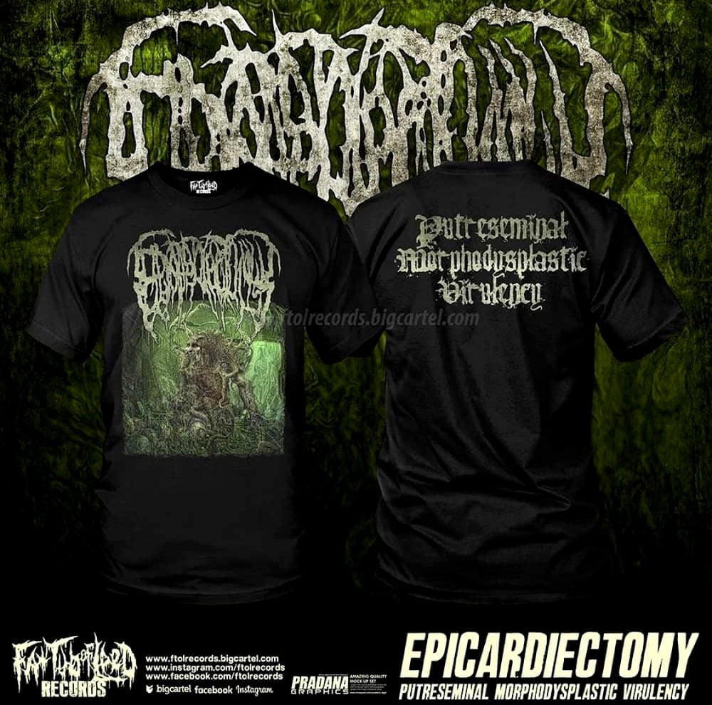 Epicardiectomy 