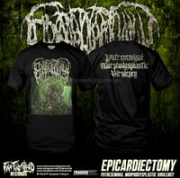 Image 1 of Epicardiectomy 