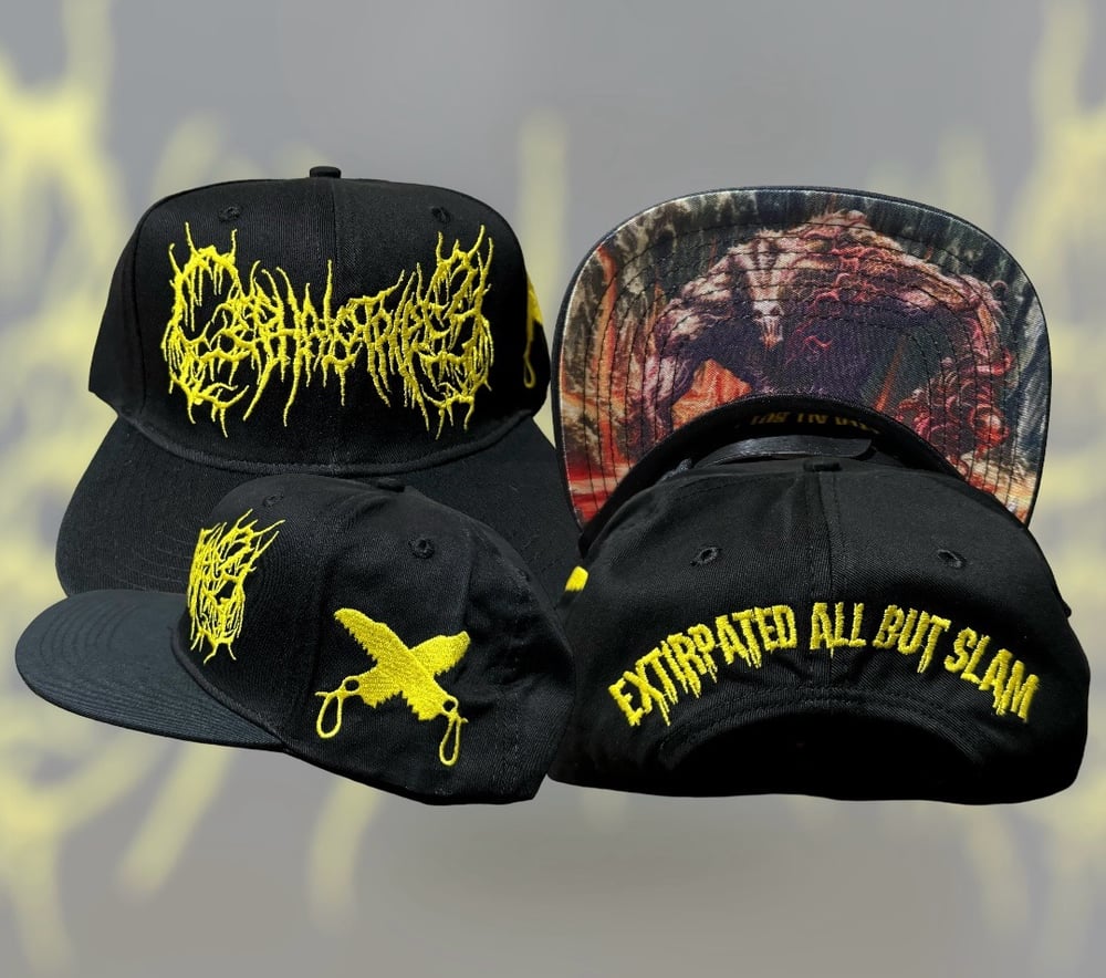 Cephalotripsy - Snapback