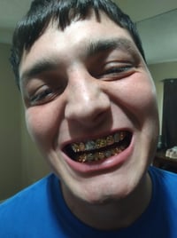 Image 3 of 6/6 Top and bottom 10k Solid Gold Grill set Deal 