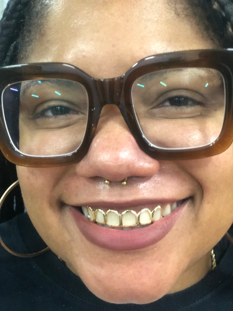 Image of 6 teeth grillz 10k yellow gold