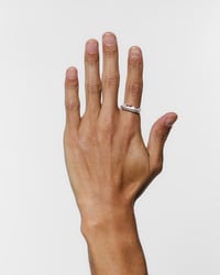 Image 3 of Humerus Ring