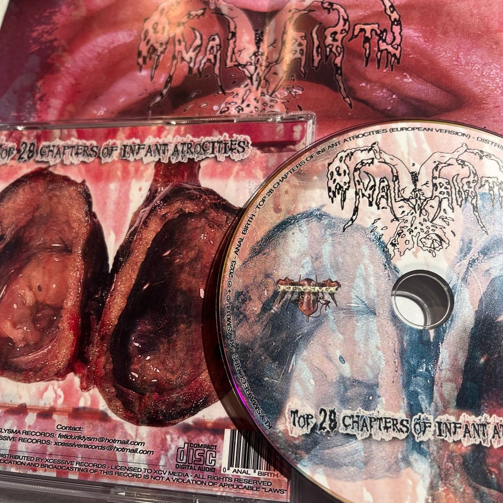 Anal Birth – “Top 28 Chapters Of Infant Atrocities” CD
