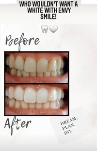 Image 4 of Smile Now - Pay Later