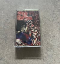 Image 1 of Artery Eruption Gouging Out Eyes of Mutilated Infants tape