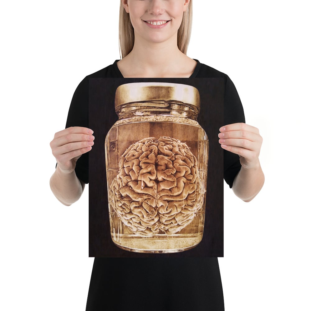 Photo Print: Brain Wet Specimen (black)