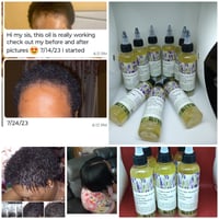 Image 2 of Kadian's Hair Growth oil