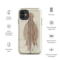 Image 2 of Antique Bookpage Detailed Anatomical Illustration Human Torso Tough Case for iPhone®