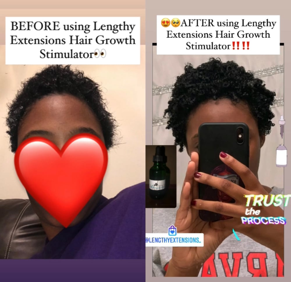 Image of Lengthy Extensions Hair Growth Stimulator