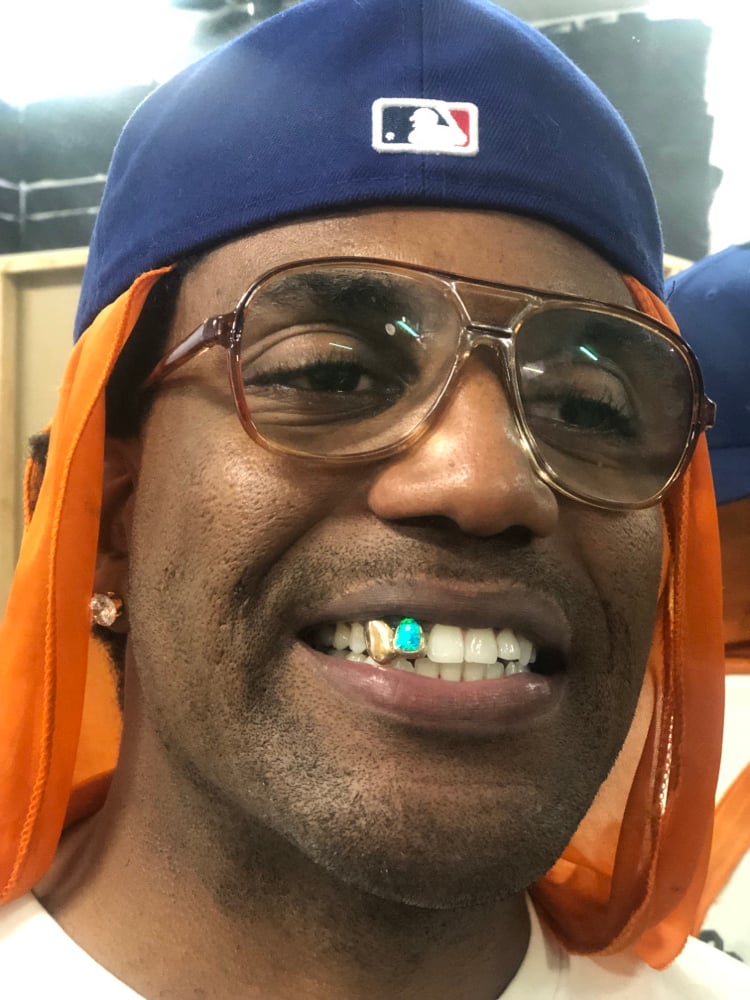 Image of 2 teeth grillz with one Opal 10k yellow gold 