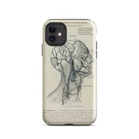 Image 1 of Antique Bookpage Detailed Anatomical Illustration Human Head Tough Case for iPhone®