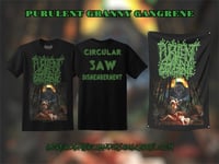 Image 1 of Purulent Granny Gangrene 