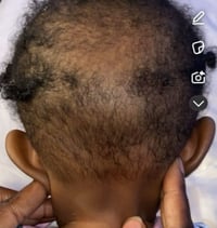 Image 2 of Levi9ne Hair & Scalp Oil