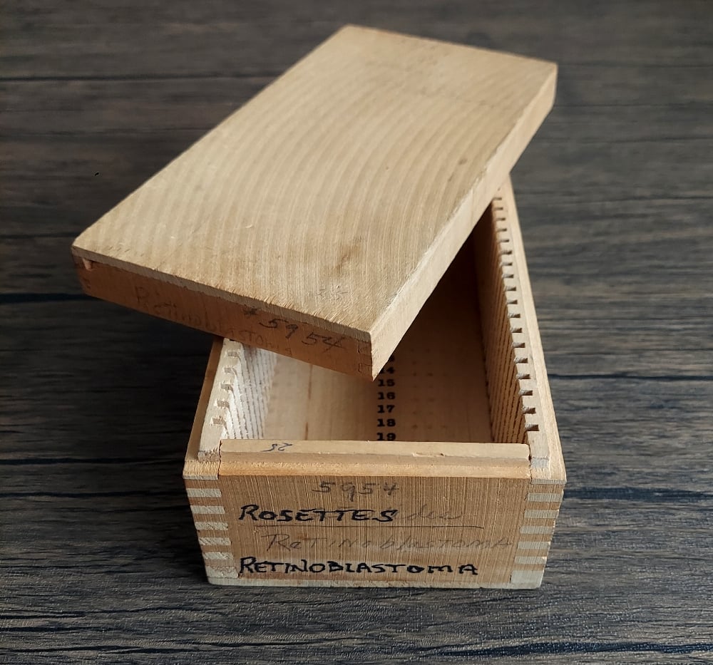 Vintage Medical Slides – Human Eye (Retinoblastimo)