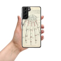 Image 9 of Antique Anatomical Drawing Bones Of The Hand Clear Case for Samsung®