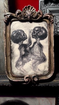 Image 2 of 'SIAMESE TWINS' [ Unique Print - { 1/1 } ] Hand Embellished Museum Archival Print 