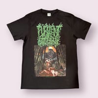 Image 3 of Purulent Granny Gangrene 