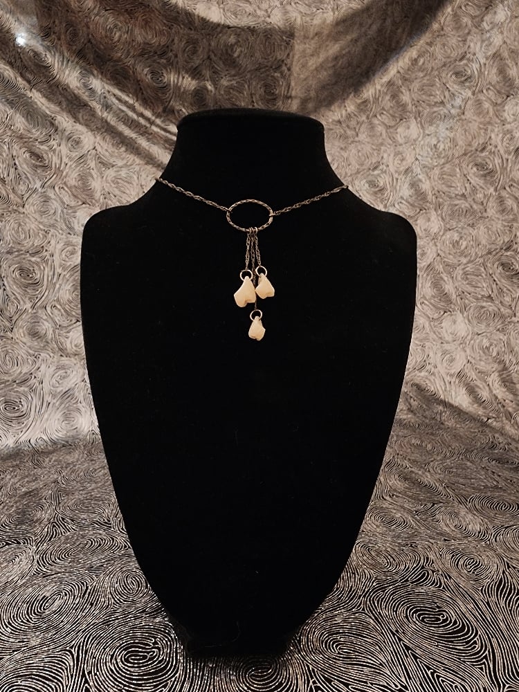 Image of teeth choker