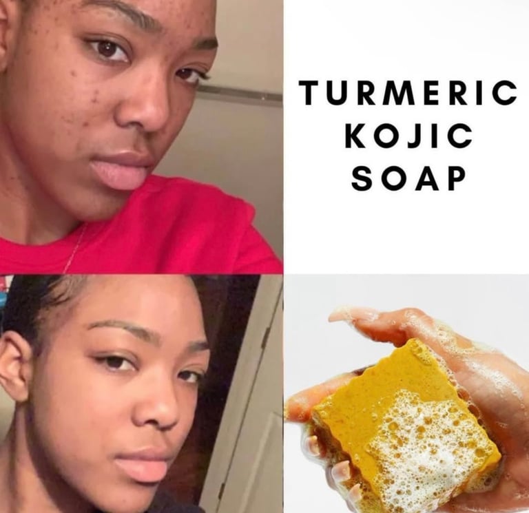 Curcuma , carrot & papaya facial soap  Image 5