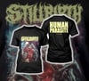 Stillbirth 