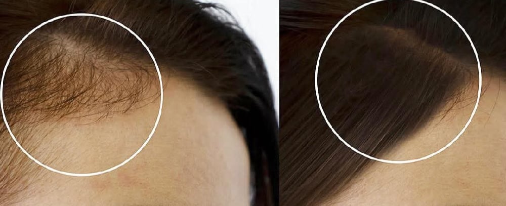 B-A-T-A-N-A Hair/Scalp Nourisher/Regenerator! Hair Loss. Eczema/Acne. Stretch Marks/Scars. UV Rays