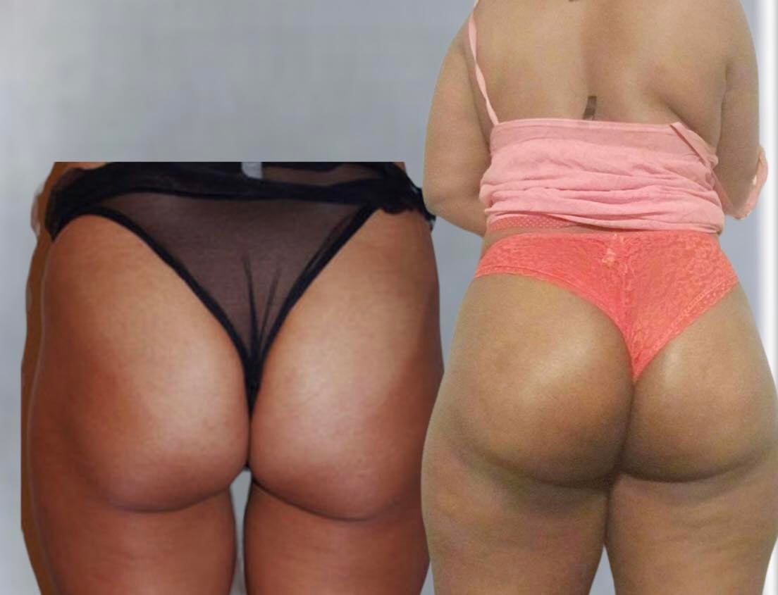 Image of BEST ENLARGEMENT BUT FOR WOMEN