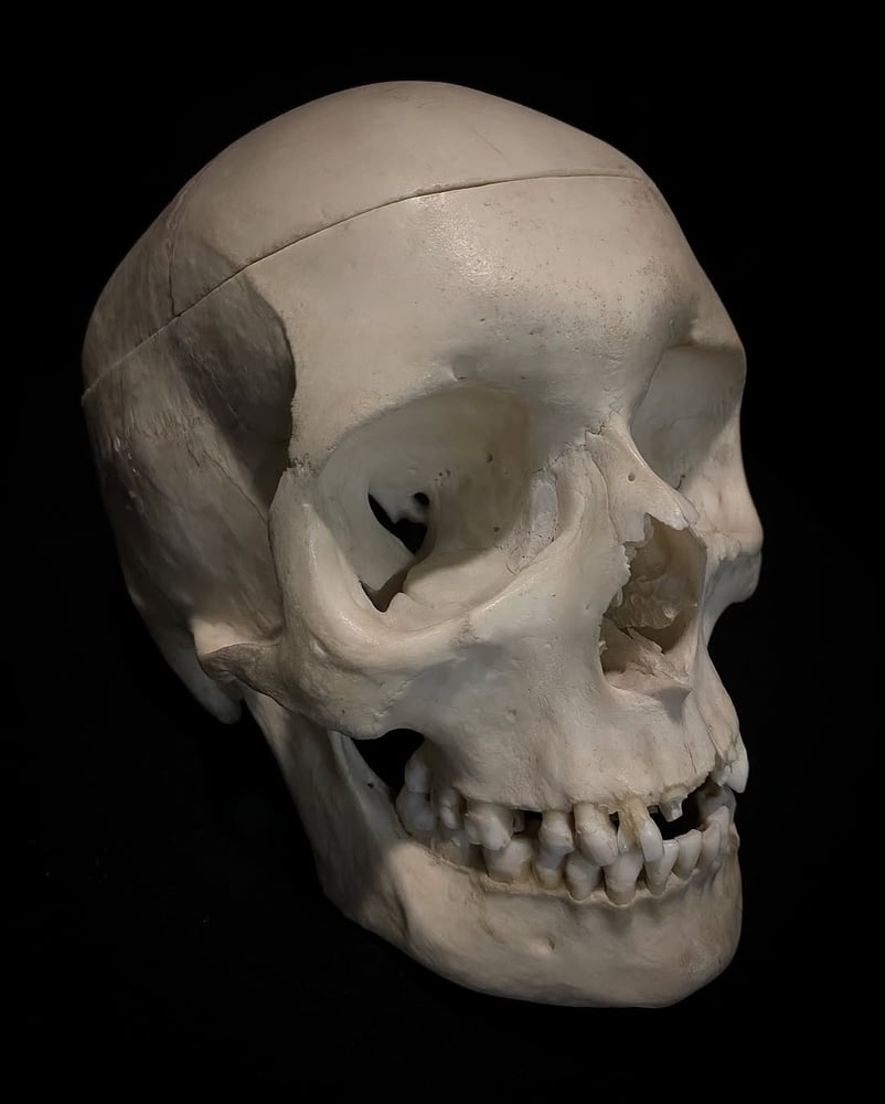 Image of Real Human Skull