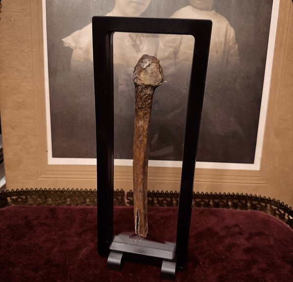 Image of Human Ulna Bone 