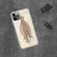 Image 4 of Antique Bookpage Detailed Anatomical Illustration Human Torso Clear Case for iPhone®