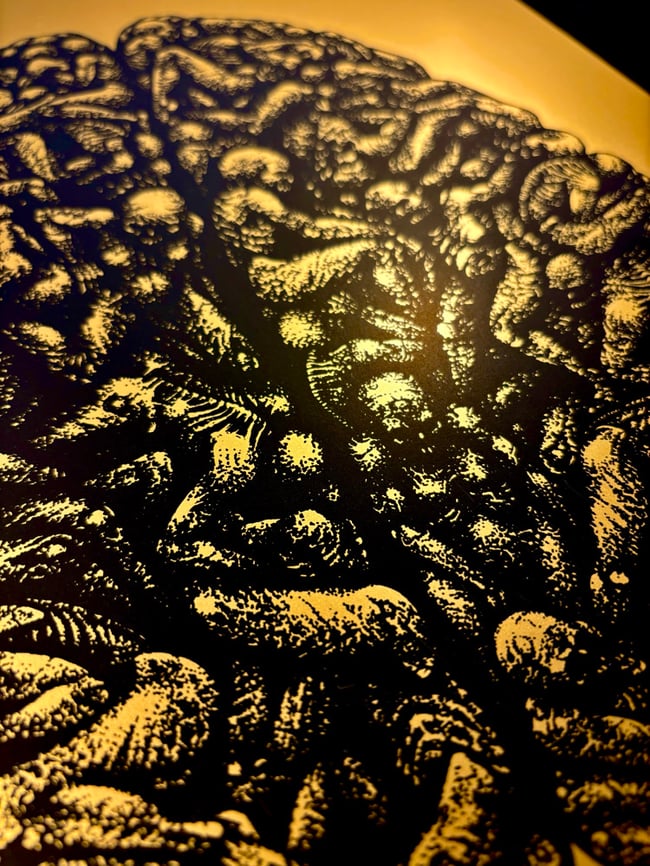 Brain Death Gold
