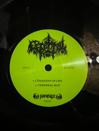 Image 3 of CEREBRAL ROT -“Cessation Of Life”