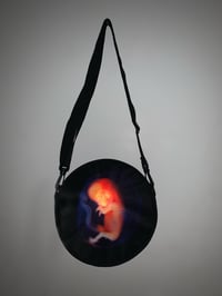 Image 1 of My very own fetus