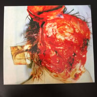 Image 1 of Lymphatic Phlegm - Pathogenesis Infest Phlegmsepsia 20 Year Anniversary Reissue SLIPCASE CD 