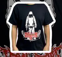 Image 1 of Nephrectomy - Brutal West Side Slam United