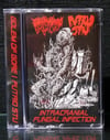 Golem of Gore // Putrid Stu: split- tape