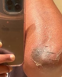 Image 7 of “BRIGHTER SKIN” PEELING OIL 