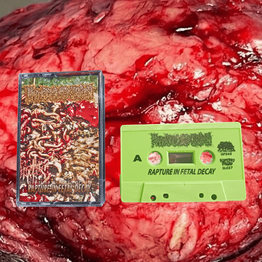 Image of Mutated Sex Organ - Rapture In Fetal Decay