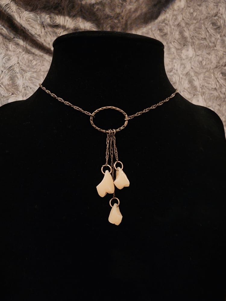 Image of teeth choker