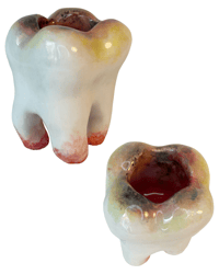 Image 1 of Decaying Tooth holder