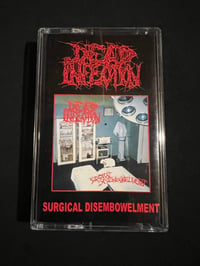 Image 1 of DEAD INFECTION - “ Surgical Disembowelment”