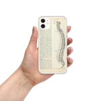 Image 8 of Vintage Book Page Anatomical Illustration Human Spine Clear Case for iPhone®