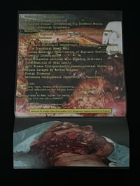 Image 3 of INFESTER - “Dissection Ward Examinations”
