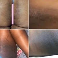 Image 5 of ROSEMARY SKIN BRIGHTENING INNER THIGH CREAM, “SLATE” SKIN BRIGHTENING EXFOLIATING SUGAR SCRUB