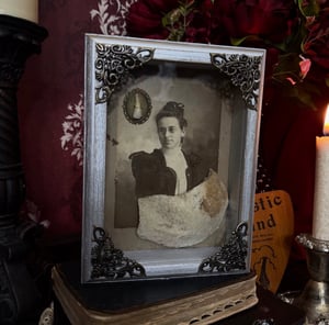Image of Victorian Cabinet Card, Human Tooth & Skull Cap Fragment 