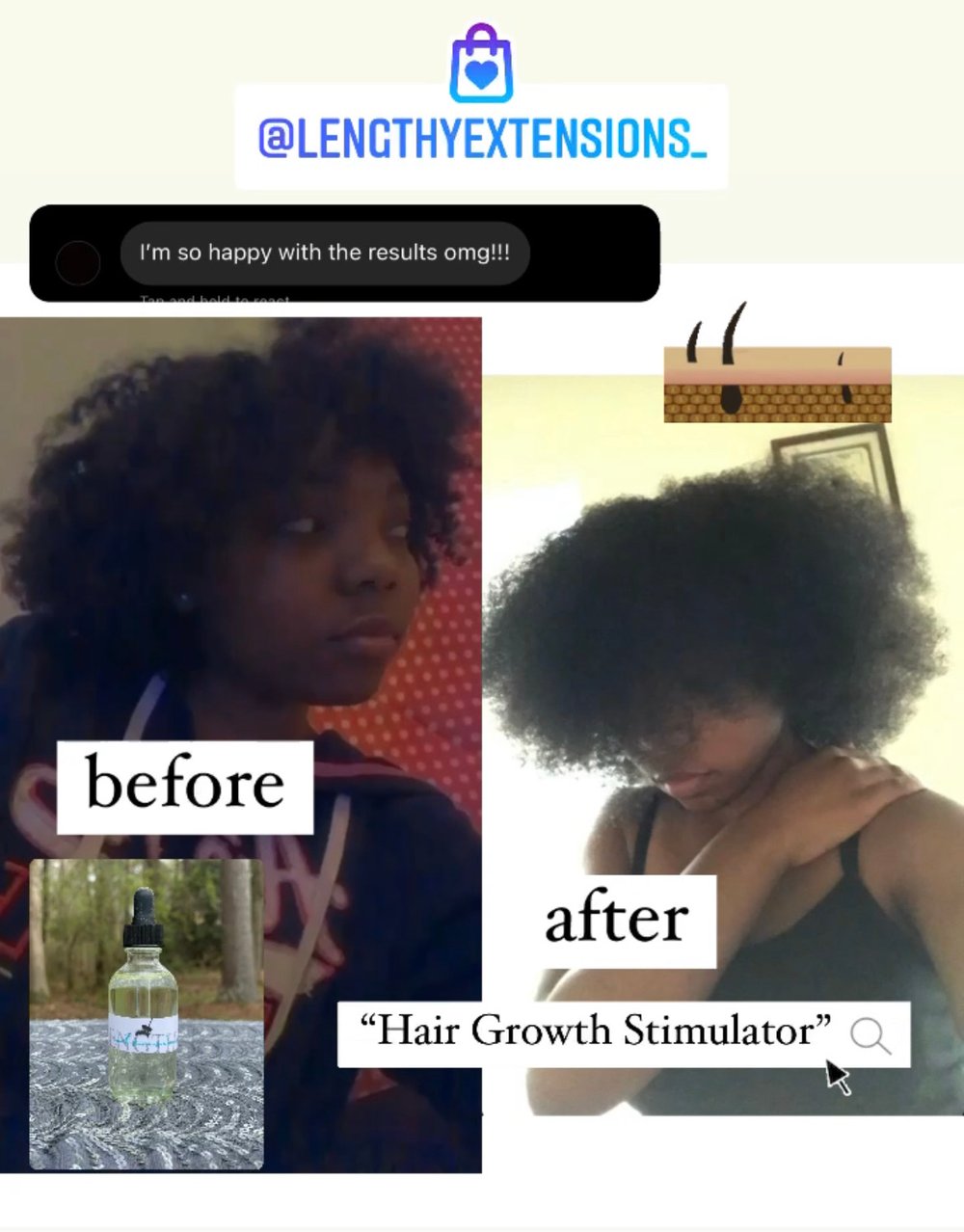 Image of Lengthy Extensions Hair Growth Stimulator
