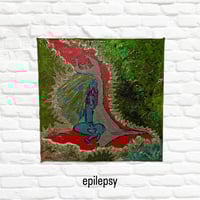 Epilepsy